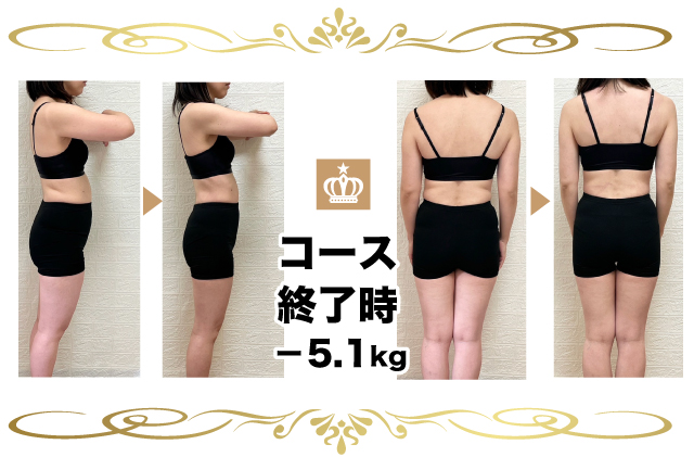 産後骨盤矯正のビフォーアフター