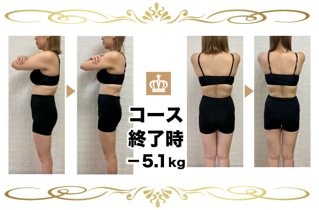 産後骨盤矯正のビフォーアフター